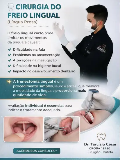 Informações sobre cirurgia do freio lingual