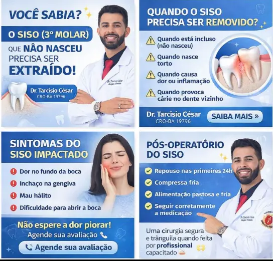 Informações sobre indicação, sintomas e pós-operatório do siso